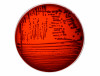 Eazyplex SuperBug AmpC