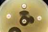 Eazyplex Superbug CRE