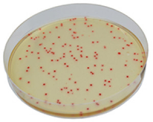 CHROMagar C. perfringens 5000ml