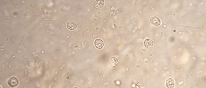 Cryptosporidium Positive Control