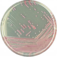 CHROMagar MRSA 5000 ml + supplement