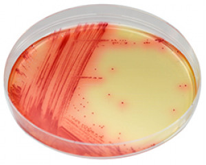 CHROMagar Mycoplasma 1000ml