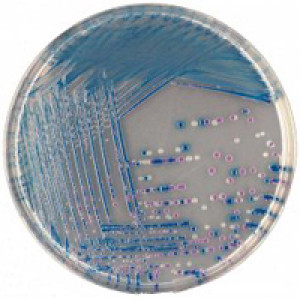 CHROMagar O157 5000ml