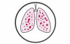 Eazyplex Pneumocystis Jirovecii