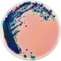 CHROMagar Rambach Agar 5000ml