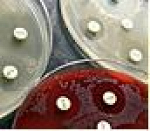 Enrofloxacin 5
