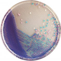 CHROMagar Salmonella Plus 5000ml + supplement