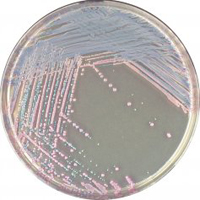 CHROMagar Staph Aureus 5000ml