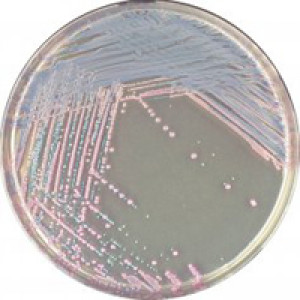 CHROMagar Staph Aureus 5000ml